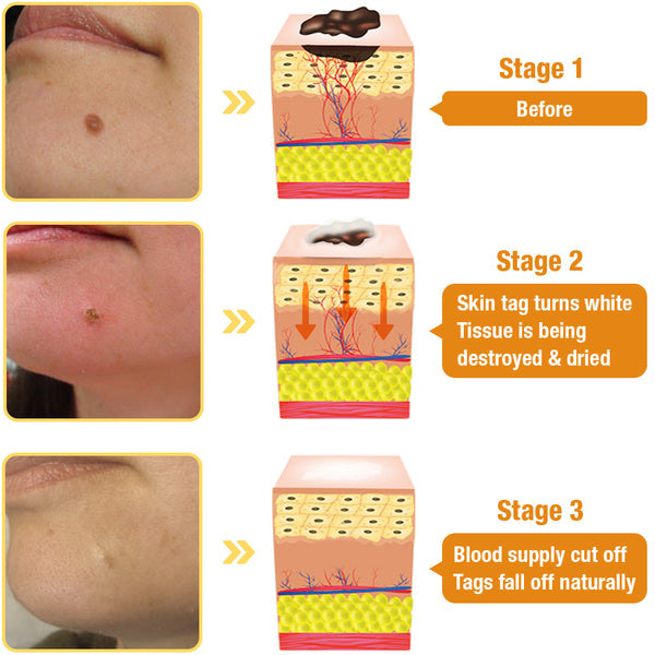 TagRecede Bee Venom Treatment Spray - 2